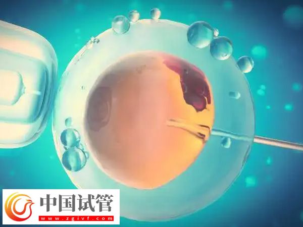 身高153做試管能不能要雙胞胎(圖1) 身高153做試管能不能要雙胞胎(圖1)