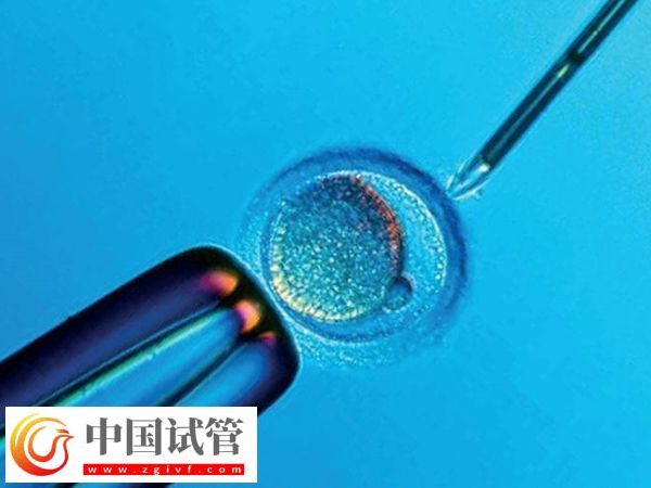 身高153做試管能不能要雙胞胎(圖2) 身高153做試管能不能要雙胞胎(圖2)