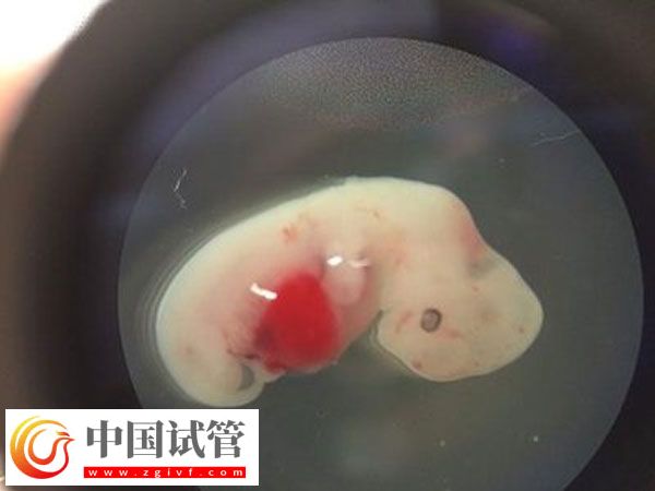 如何解讀胚胎篩查結果報告單(圖1)