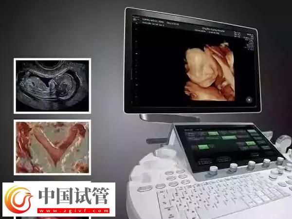 鷹潭公立三甲醫(yī)院做一次四維彩超多少錢(qián)？(圖1)