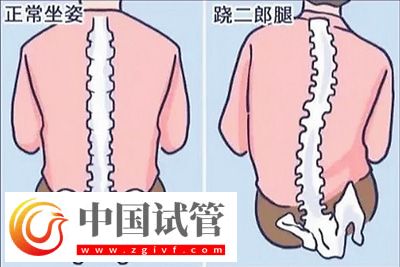 不良體態正悄悄損害你的健康(圖2)