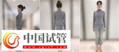 不良體態正悄悄損害你的健康(圖4) 不良體態正悄悄損害你的健康(圖4)