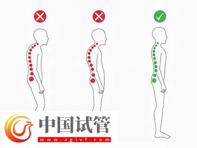 不良體態正悄悄損害你的健康(圖1) 不良體態正悄悄損害你的健康(圖1)