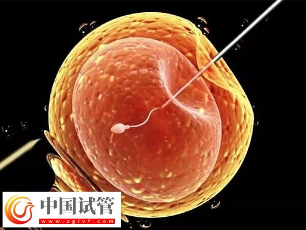 100%生女兒醋洗秘方，用什么醋、比例多少一看便知(圖1)