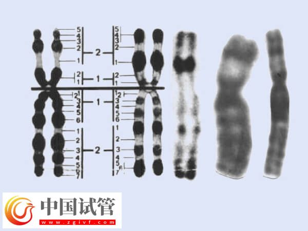 做試管2號染色體重復有什么影響(圖1)