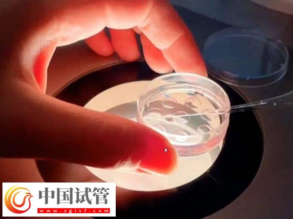 胚胎移植后大便不成形怎么回事(圖1)