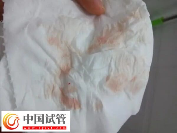 胚胎移植后大便不成形怎么回事(圖2)