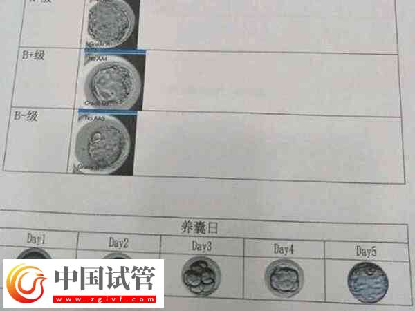 囊胚4bb和4bc移植哪個比較好(圖1)