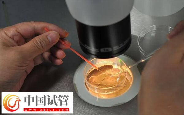 為什么醫生不給移植鮮胚(圖1)