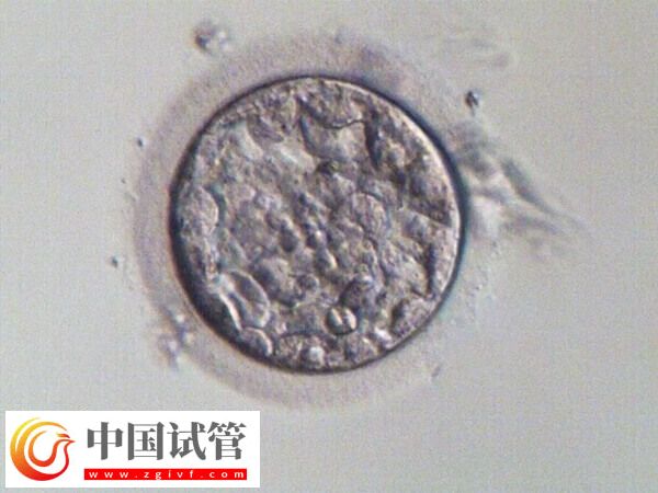 試管一次不成功二次移植費用多少(圖3)