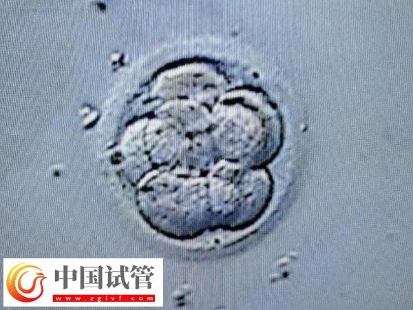 試管一次不成功二次移植費用多少(圖2)