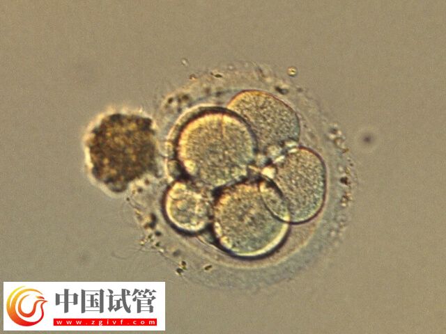 囊胚4bb和5bb哪個成功率高(圖1)