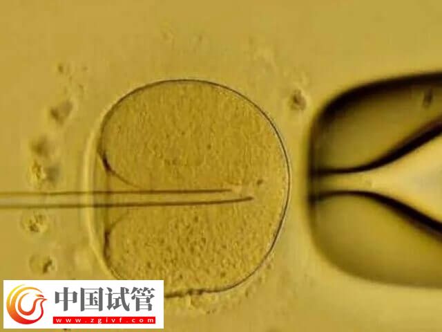 5天囊胚和3天鮮胚有哪些區別(圖2)