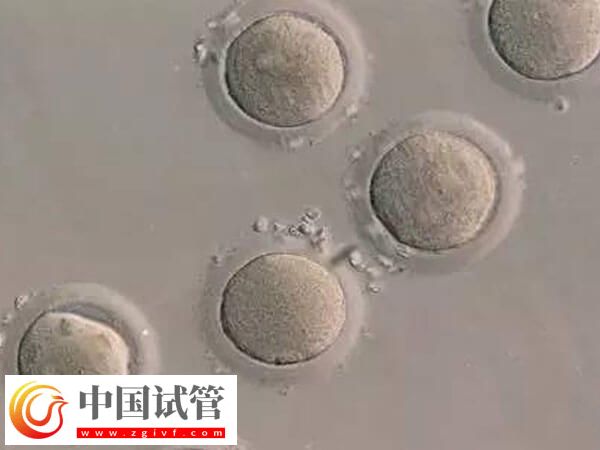 哪些情況不能移植鮮胚(圖1)