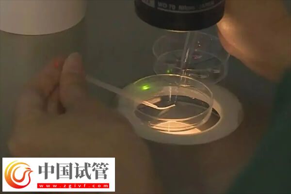 試管嬰兒一次放幾個(gè)胚胎好(圖2)