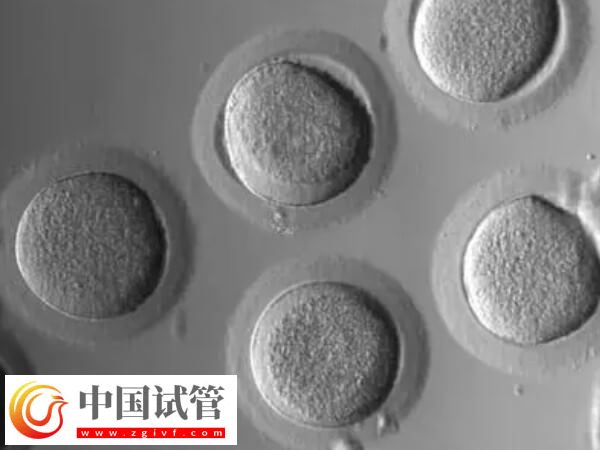 促排卵后卵泡不長怎么辦(圖2)