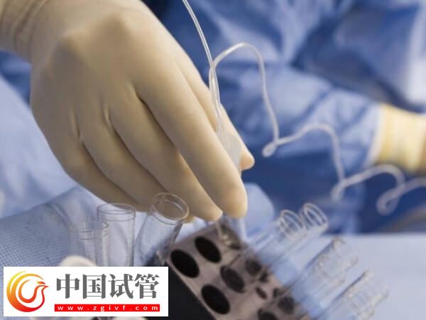 如何保證冷凍后的卵子質量(圖1)