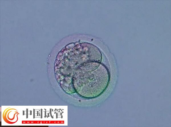 做試管月經不規律的移植方案分享，激素替代周期為其一(圖2)