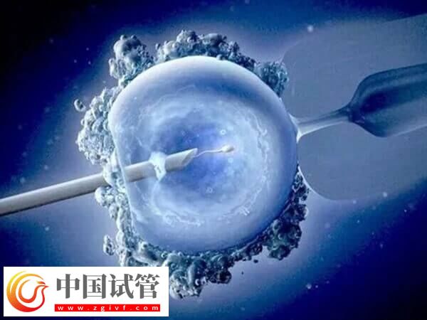 試管嬰兒CET和FET是什么意思(圖2)