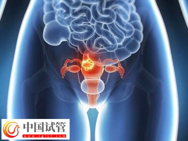 促排卵泡少可不可以降調(diào)(圖2) 促排卵泡少可不可以降調(diào)(圖2)