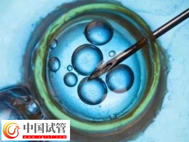 上海試管醫(yī)院排名前十名(圖1)