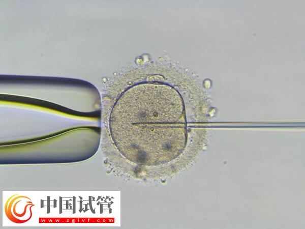 pgs篩查會淘汰多少囊胚(圖1)
