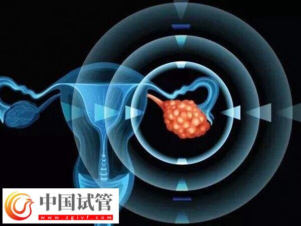 24歲卵巢早衰醫(yī)生說不用治怎么回事(圖1)
