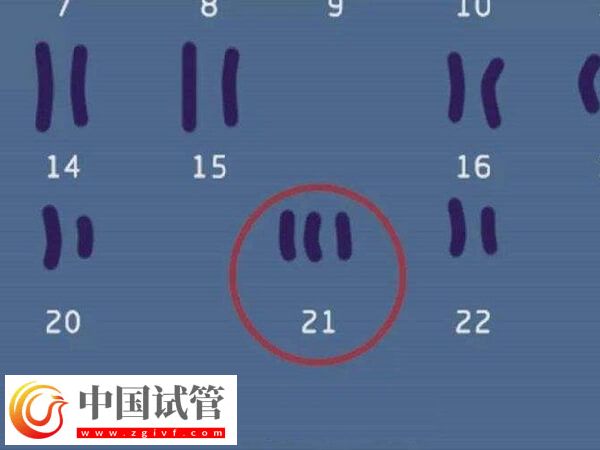 22號染色體異常還能不能要孩子(圖1)