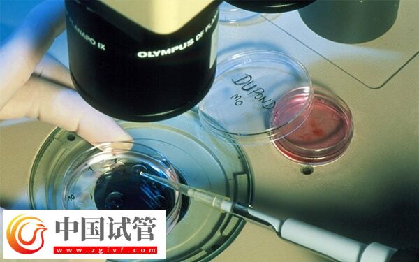 ivf和icsi的區(qū)別是什么(圖2)