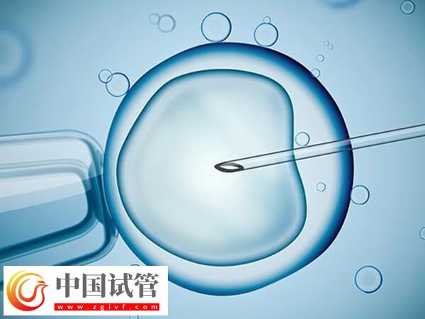 ivf和icsi的區(qū)別是什么(圖1)