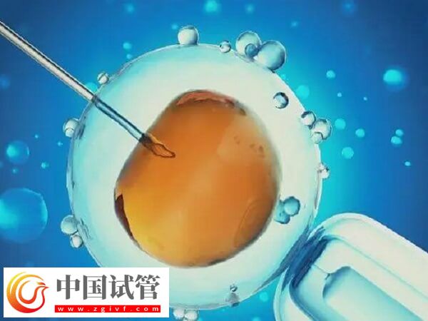 北京和上海做試管哪個(gè)技術(shù)好(圖1)