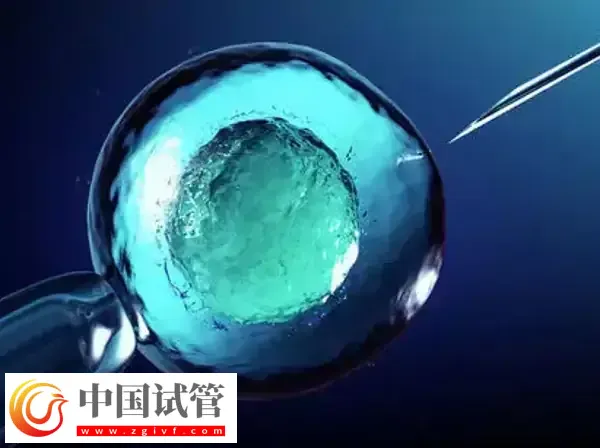 北京和上海做試管哪個(gè)技術(shù)好(圖2)