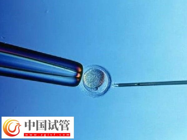 北京試管嬰兒成功率最高的醫(yī)院是哪個(圖1)