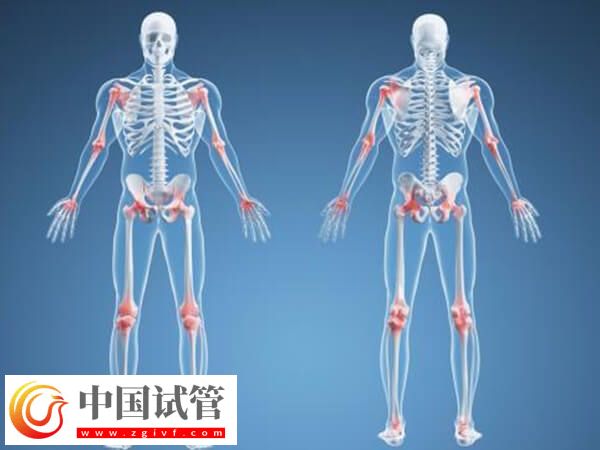 骨折愈合一年可不可以做試管(圖1)