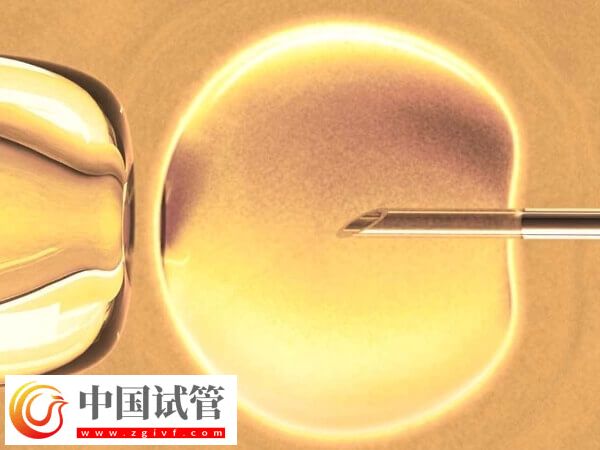 做試管促排卵要注意什么(圖1)