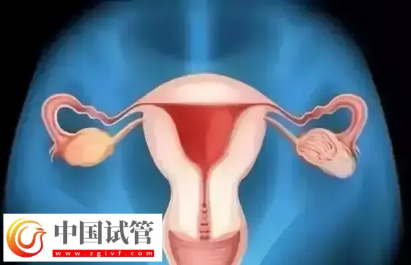 腹腔鏡子宮切除手術怎么做(圖1)