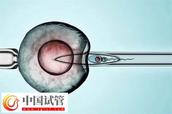 試管嬰兒改良長方案促排卵有哪些優缺點？(圖1)