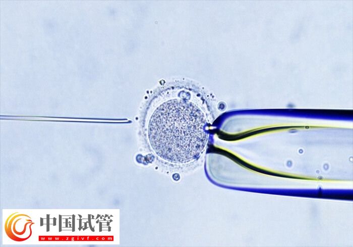 試管嬰兒助孕有幾個階段(圖1)