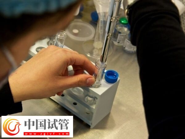 取完卵后如何判定腹水(圖1) 取完卵后如何判定腹水(圖1)